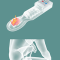 Massage device for the treatment of haemorrhoids
